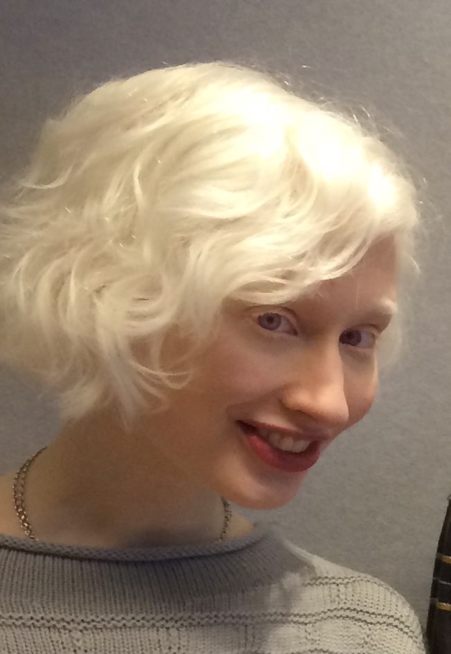 about-albinism-albinism-fellowship-of-australia